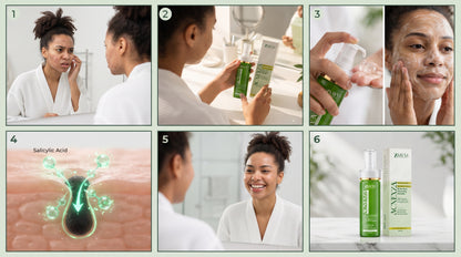 Zaavya Acnexza Anti-Acne Cleanser