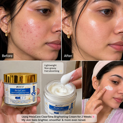 Zaavya Melacare Brightening Night Cream