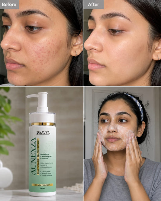 ACNEXZA Anti-Acne Gel Cleanser